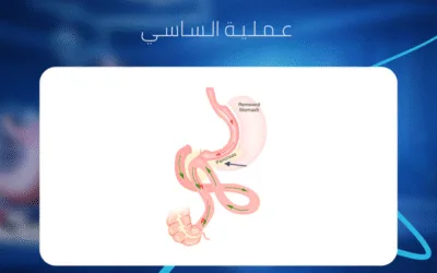 عملية الساسي