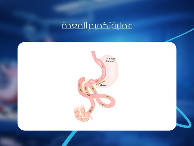 عملية الساسي